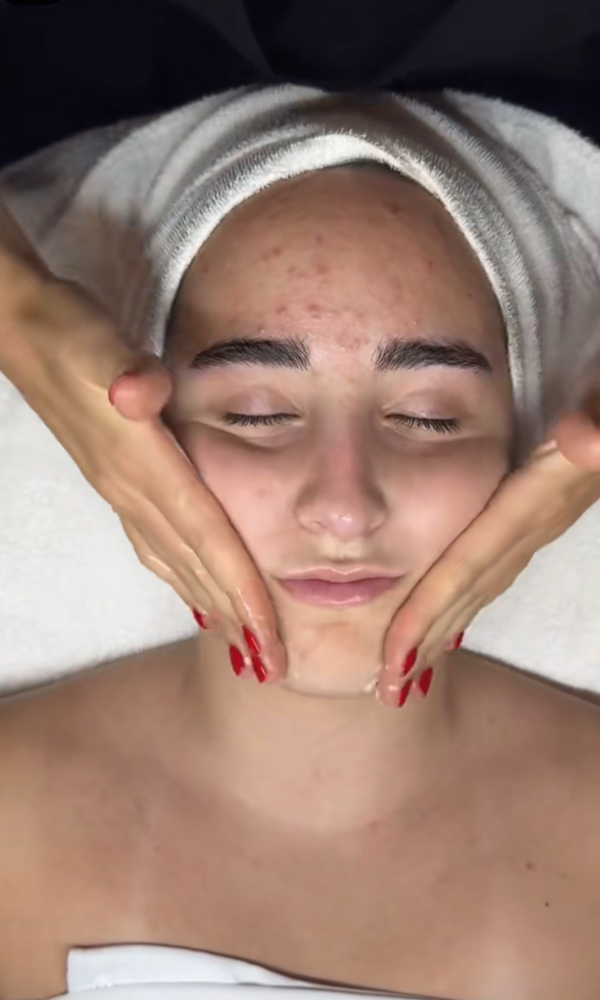 Acne Treatment Facial
