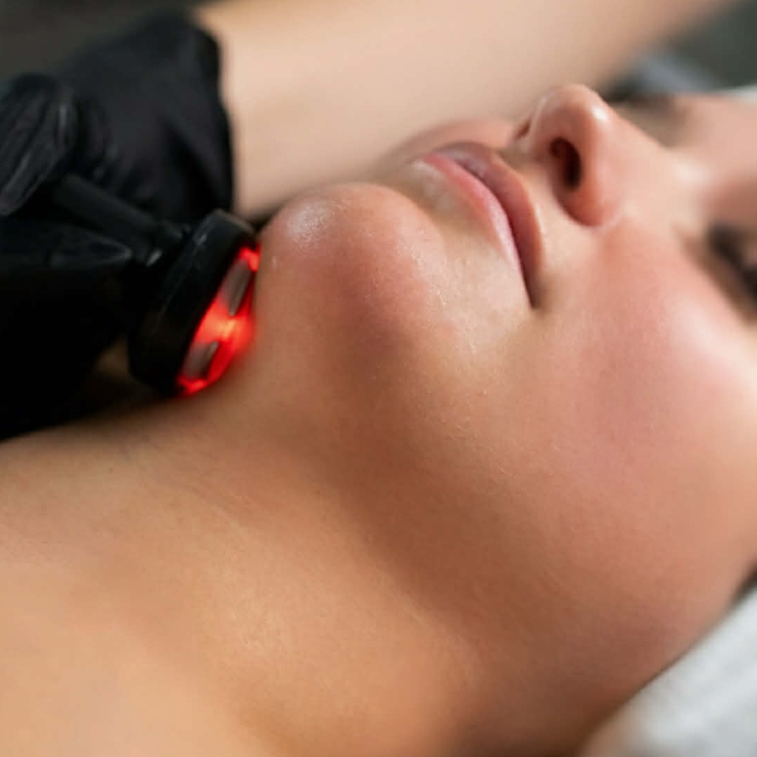 Face/Chin at Elevé Body Aesthetics in Milliken, CO