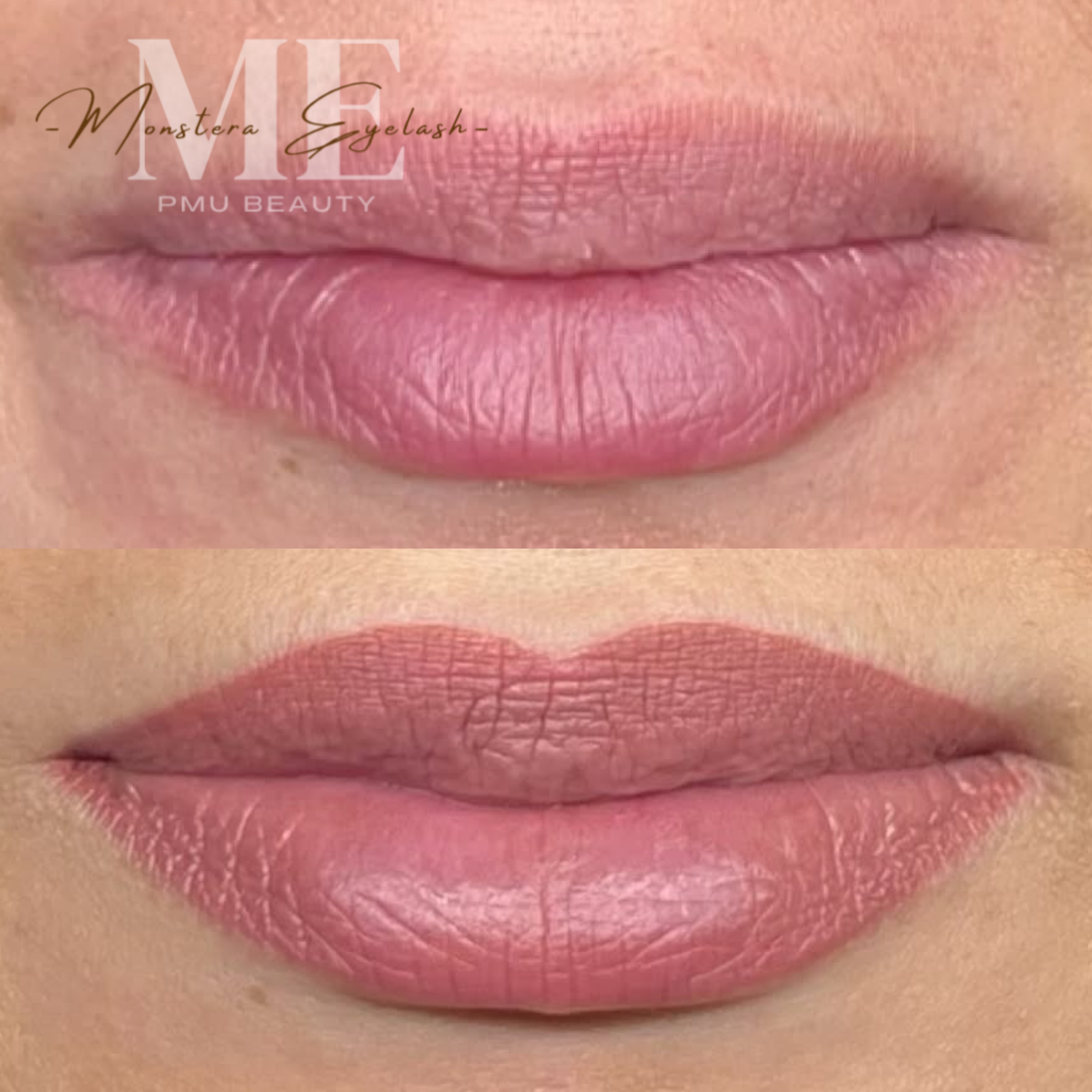 Lip Touch-Up 4-6 Week