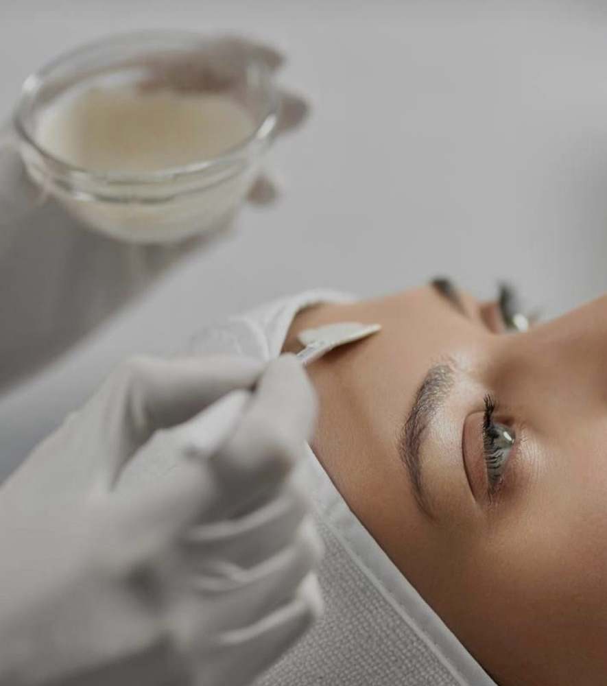 Lactic Chemical Peel