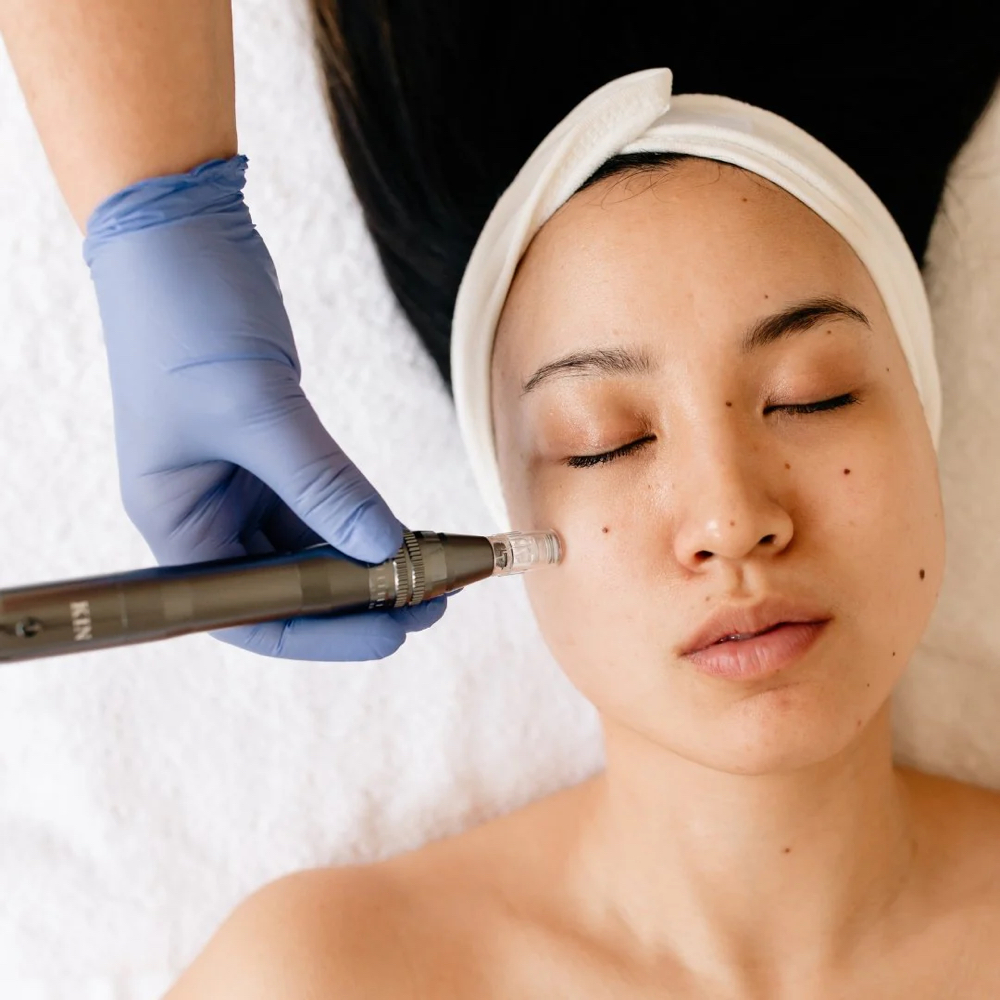 Nano-Needling Facial