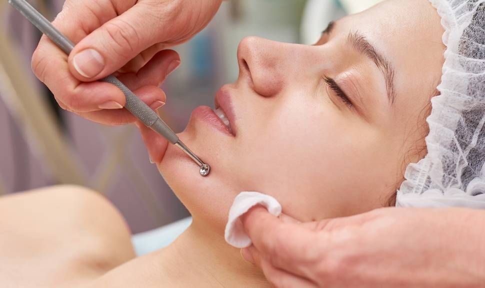 Facial con extracion