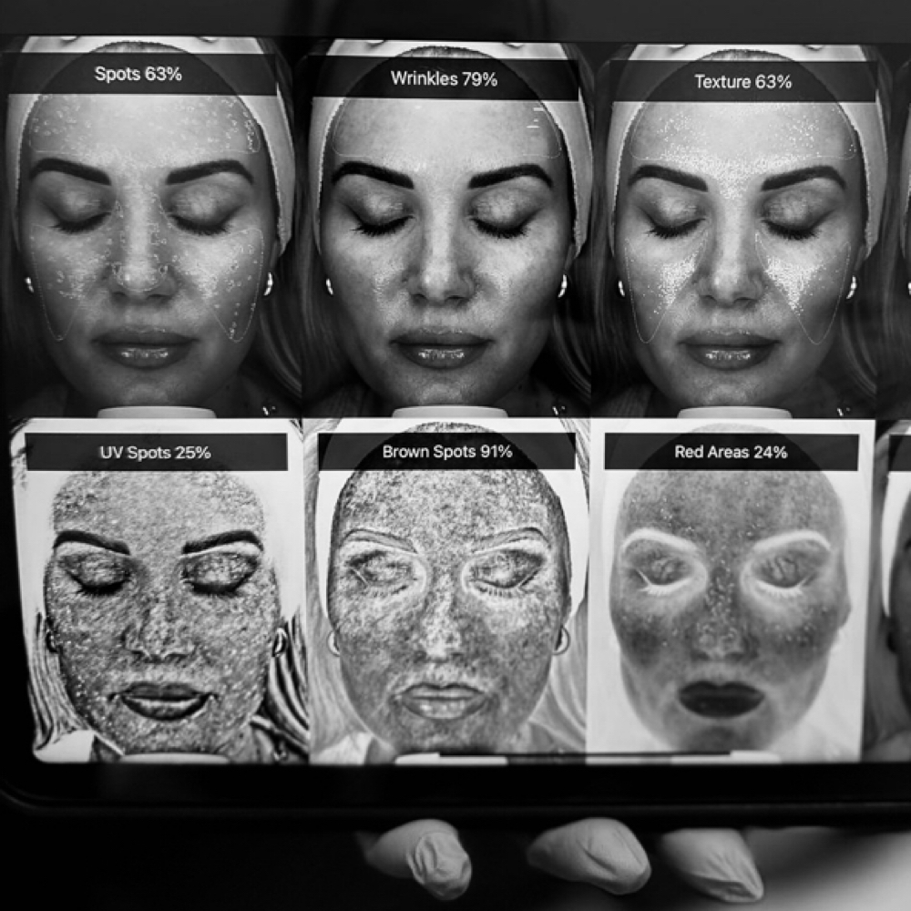 Professional Skin Scanner Analysis at Made New Aesthetics in Lone Tree, CO