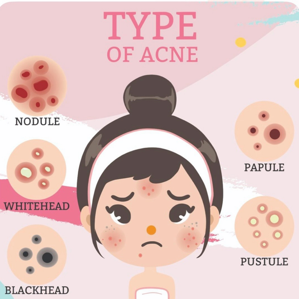 August Special- Teen Facial! at JazzelleSkin Co in Moore, OK
