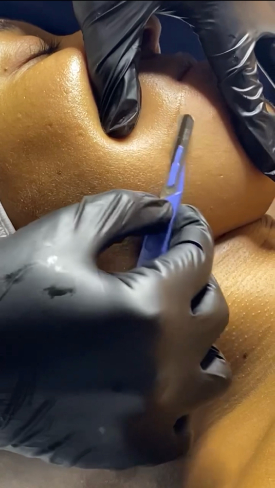 Dermaplaning Facial