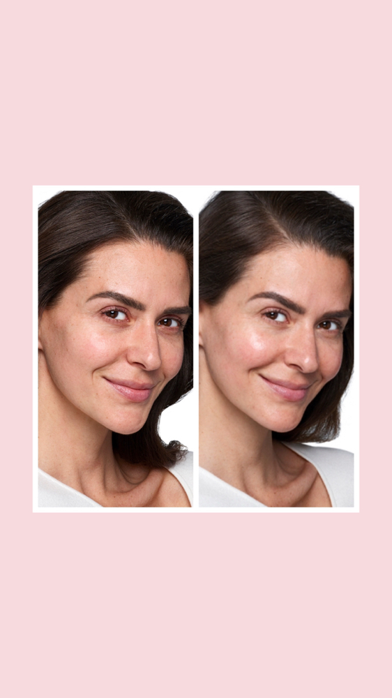 SkinVive Injectable Skincare