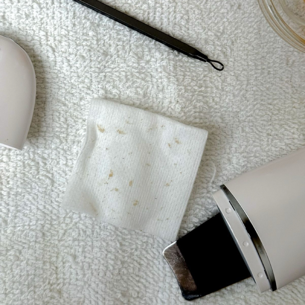 Extractions at NEW Me Skinbar in Rochester, MN