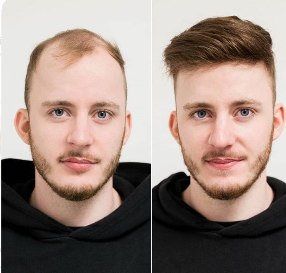 Toupee / Maintenance: