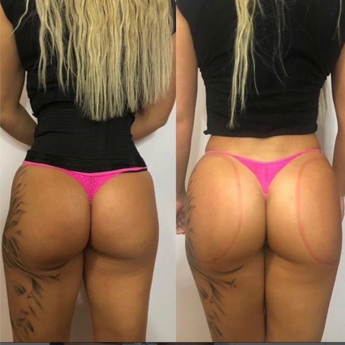 CurvSculpt Vixen at CurvSculpt in Denver, CO