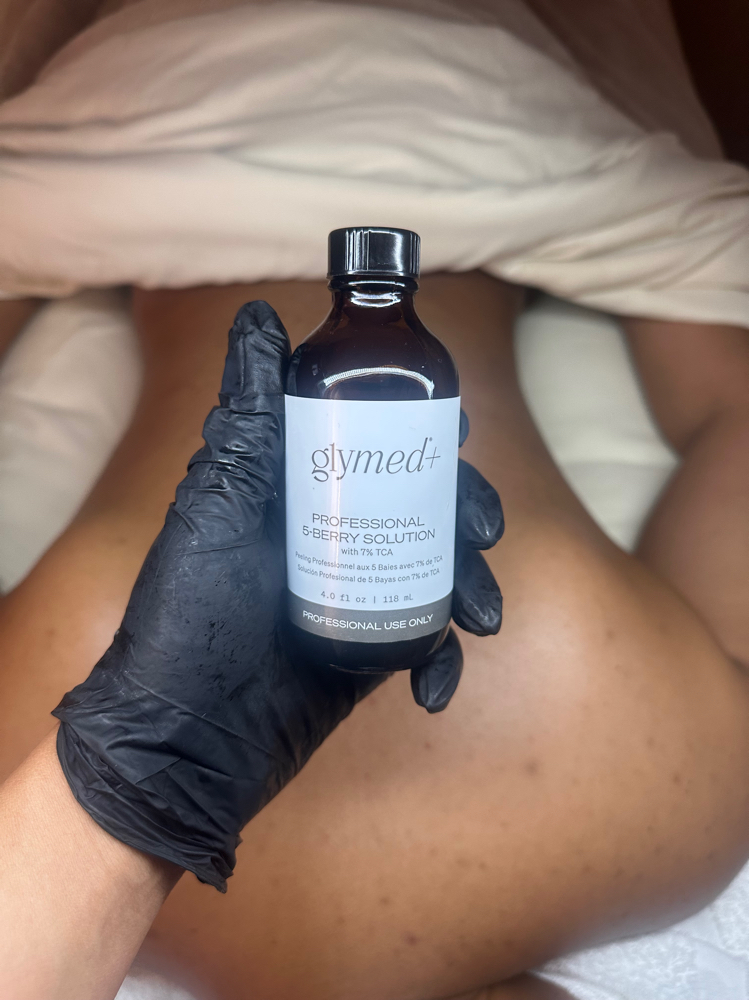 TLC Back Facial-Body Care at J Esthetics in Homewood, IL