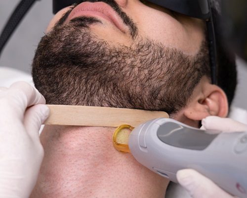 Laser Beard Shape at Loba Beauty Spa in Paterson, NJ