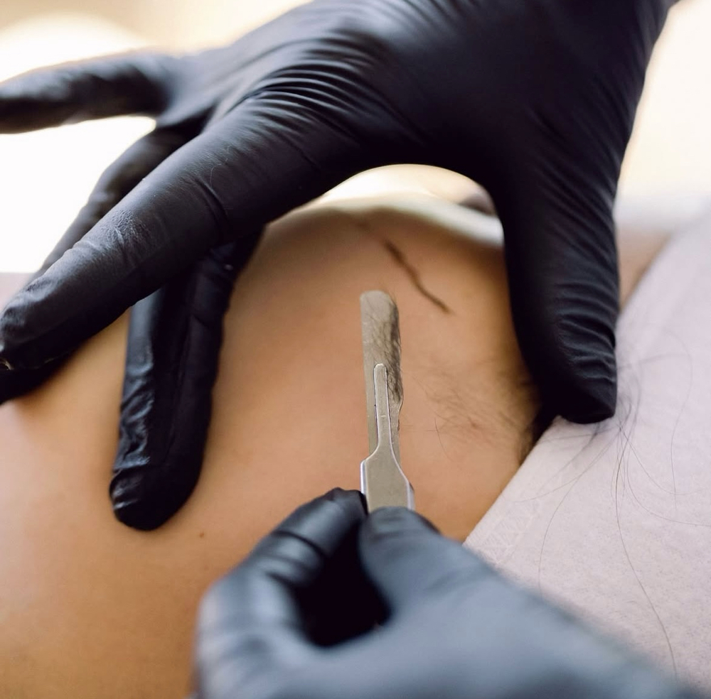 Dermaplane Luxe Facial