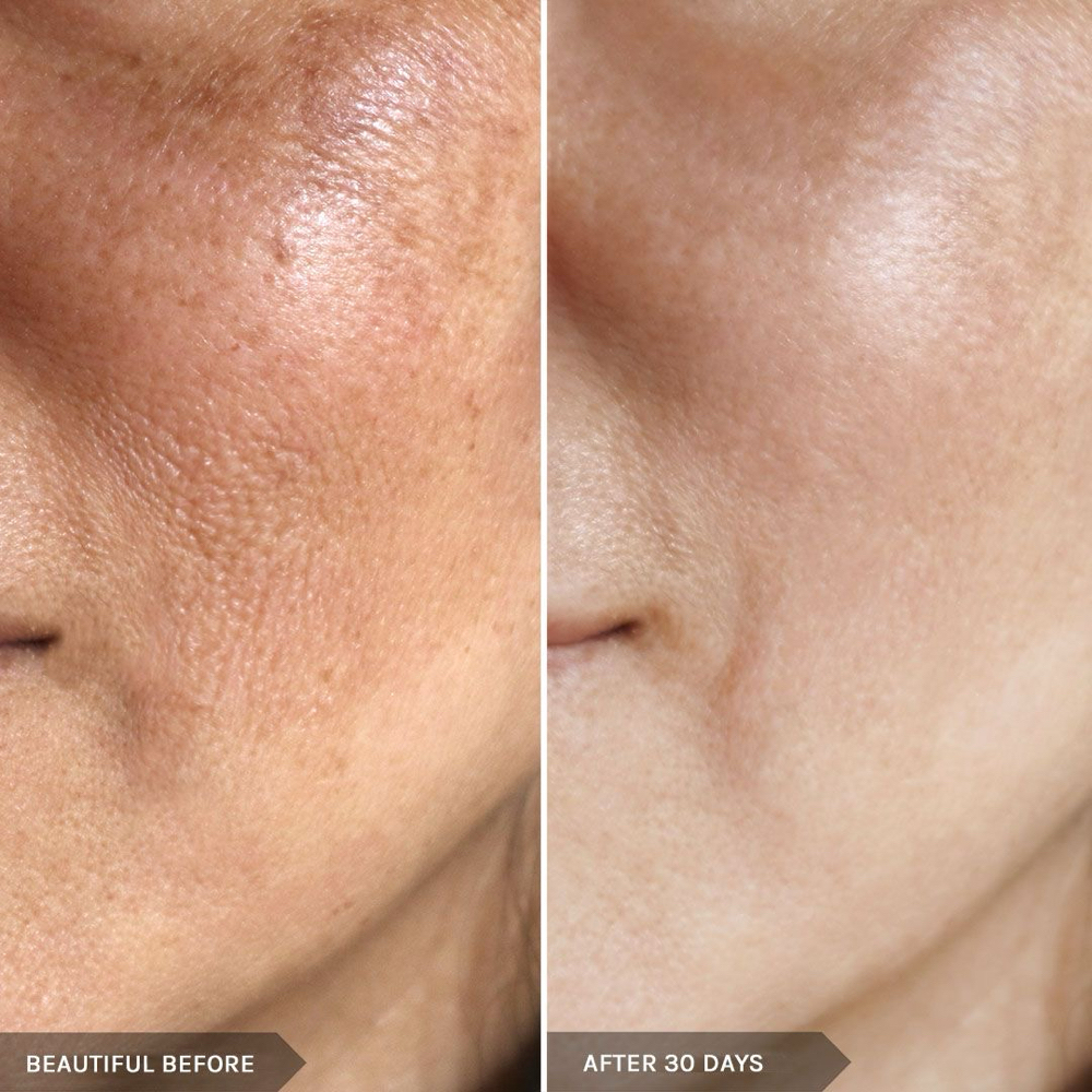 LUMECCA PEAK FACIAL at Remake Beauty Studio San Juan in San Juan, TX