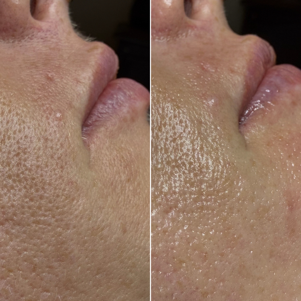 Golden Hour Facial