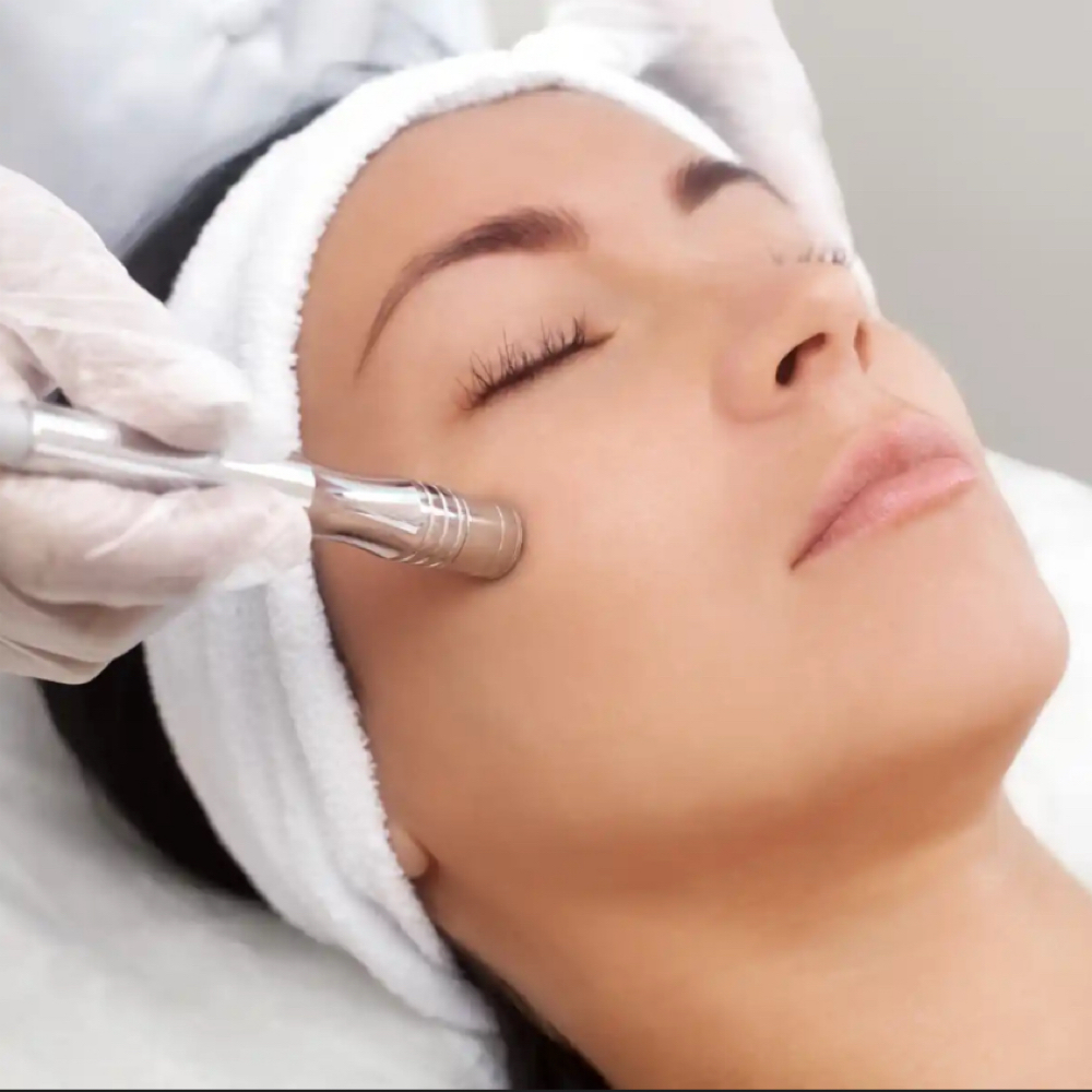 Diamond MicroDermabrasion at River & Clay Esthetics in Agawam, MA