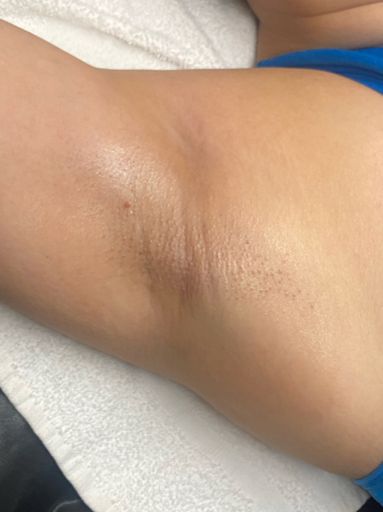 Underarm Wax