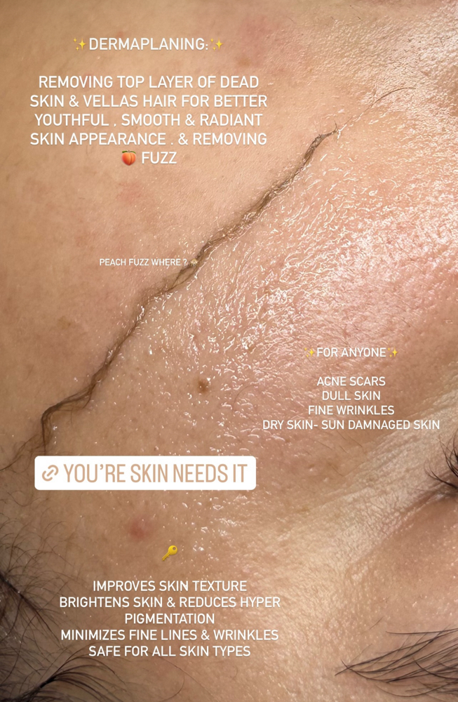 Dermaplaning Facial