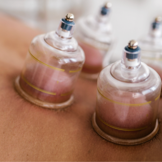 Cupping at Lotus Lounge Massage & Wellness in Jackson, MI