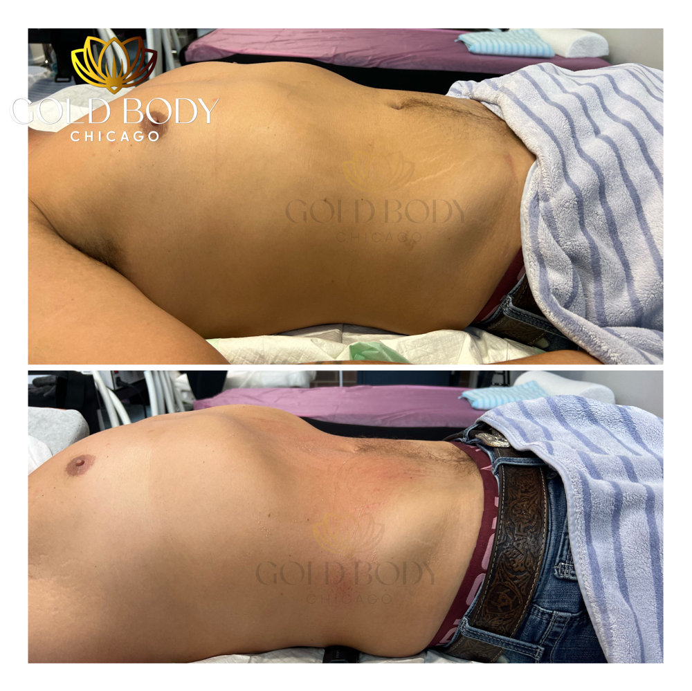 Men Sculpt Treatment