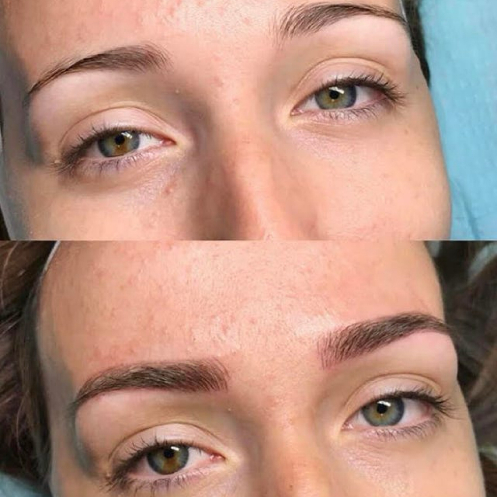 Microshading at Aura Aesthetics in Houston, TX