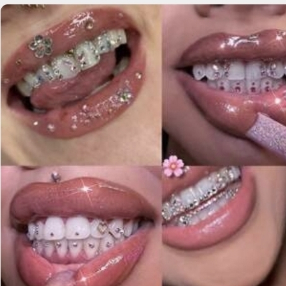 Tooth Gems (Per Tooth) at Mezmorize in Anderson, IN