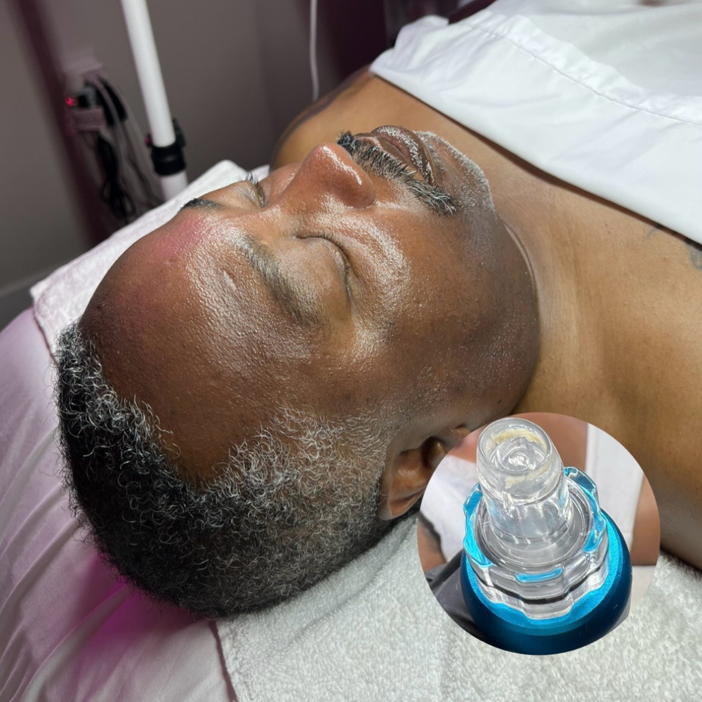 Hydrofacial with Vortex Technology at FacebyMeriee in Williamsville, NY