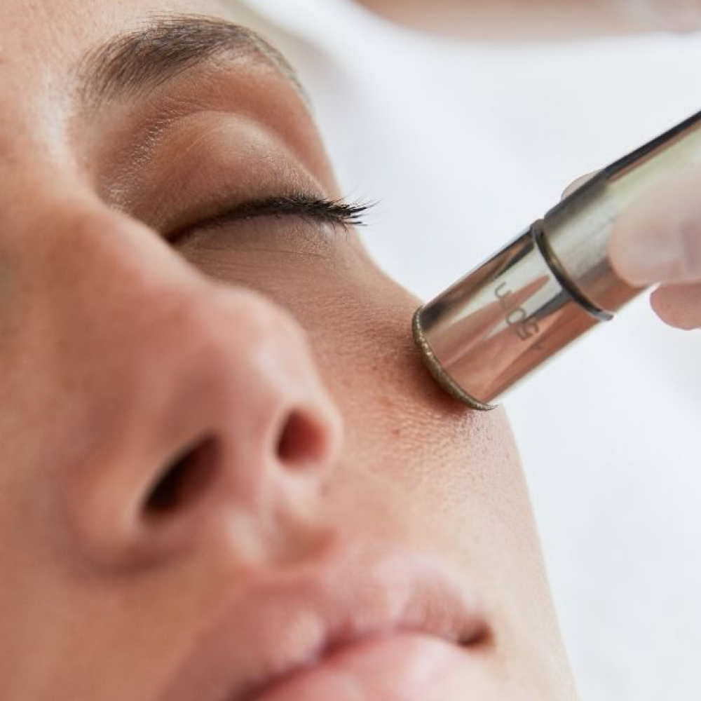 Add on Microdermabrasion at Vanessa Renee Esthetics in Easley, SC