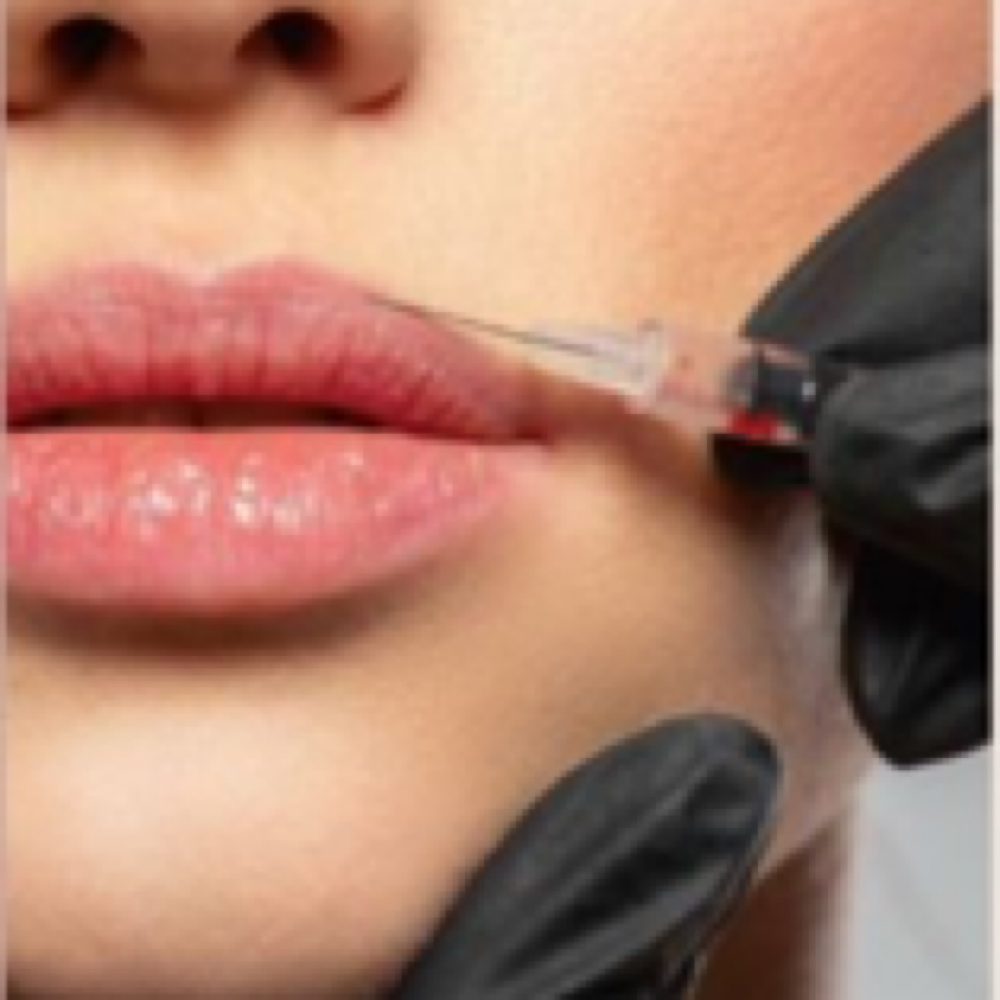Lip Filler Half Syringe at Aesthetics by Emmie in Charleston, WV