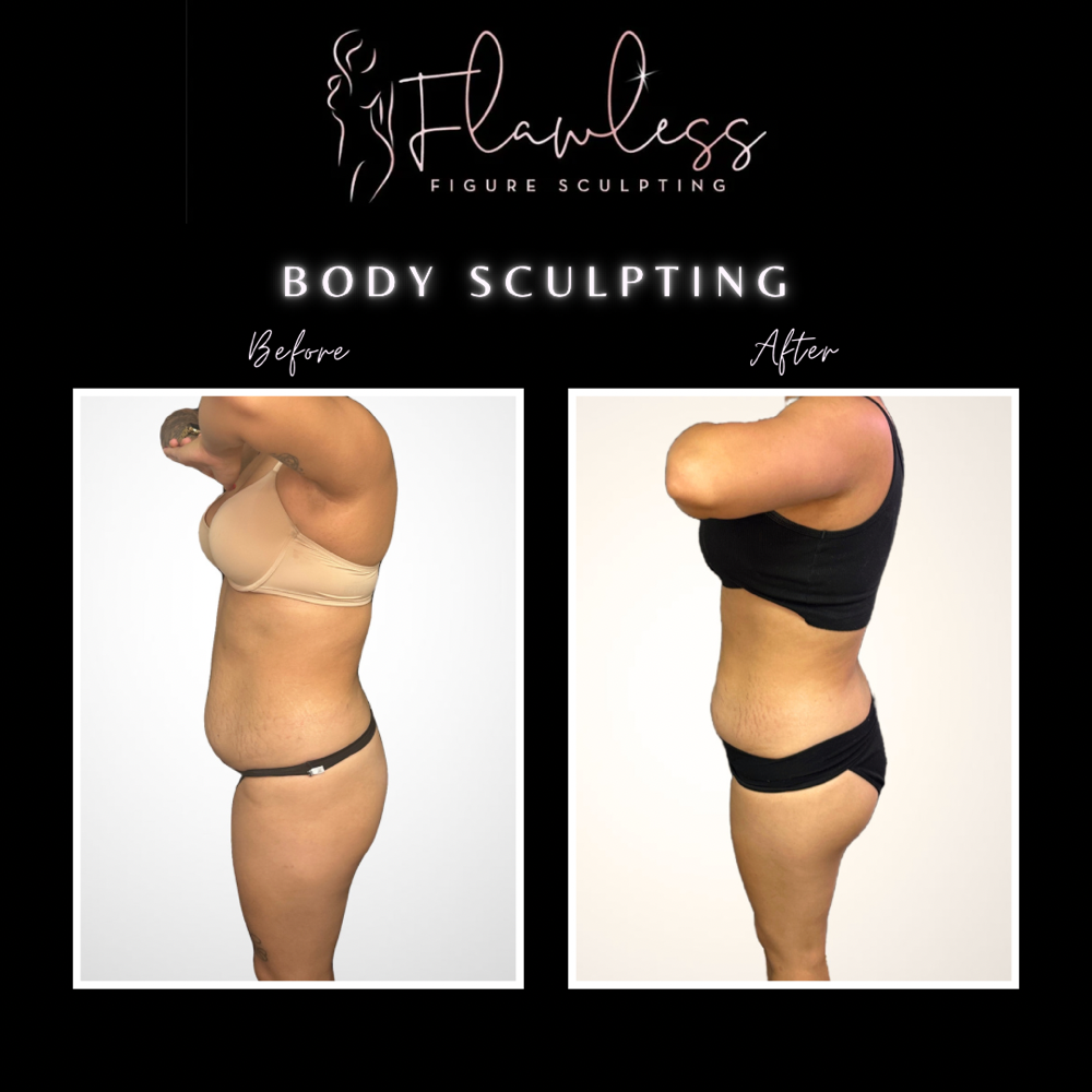 Body Sculpting Package - 4