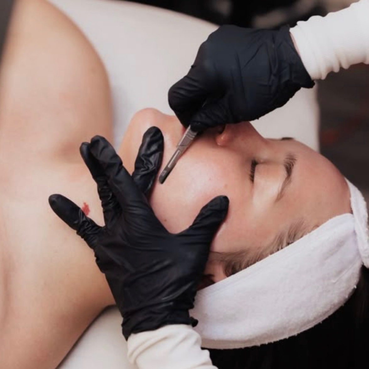 Bare Bloom Dermaplane (40 minutes)