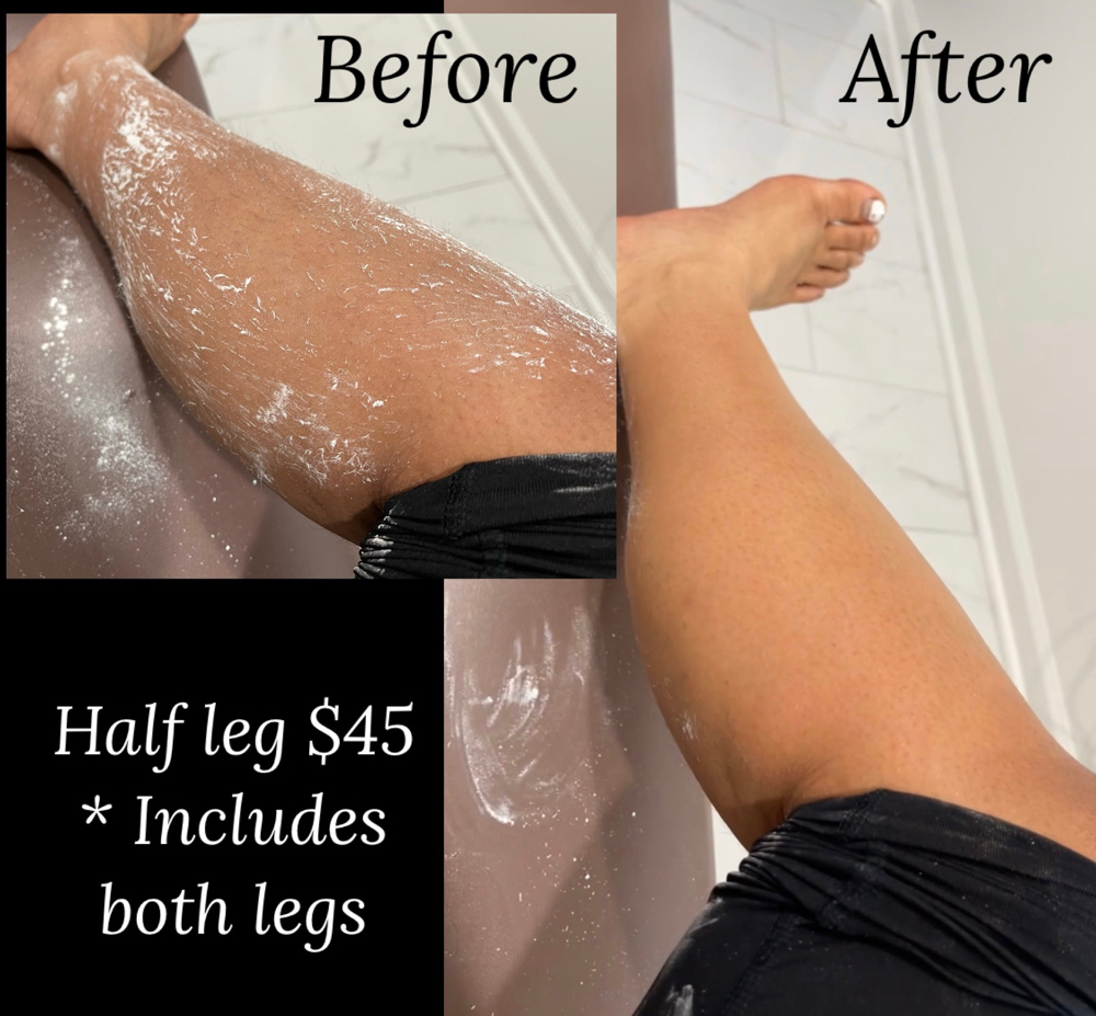 Upper Leg