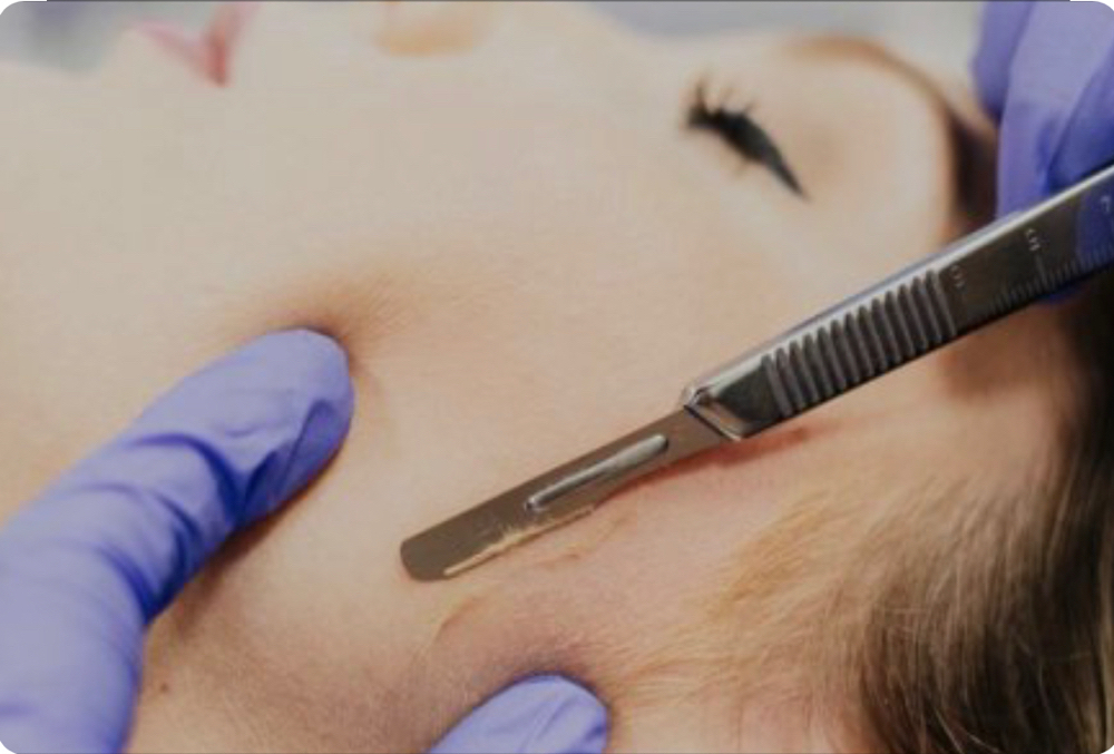 Dermaplaning (Facial Add On)