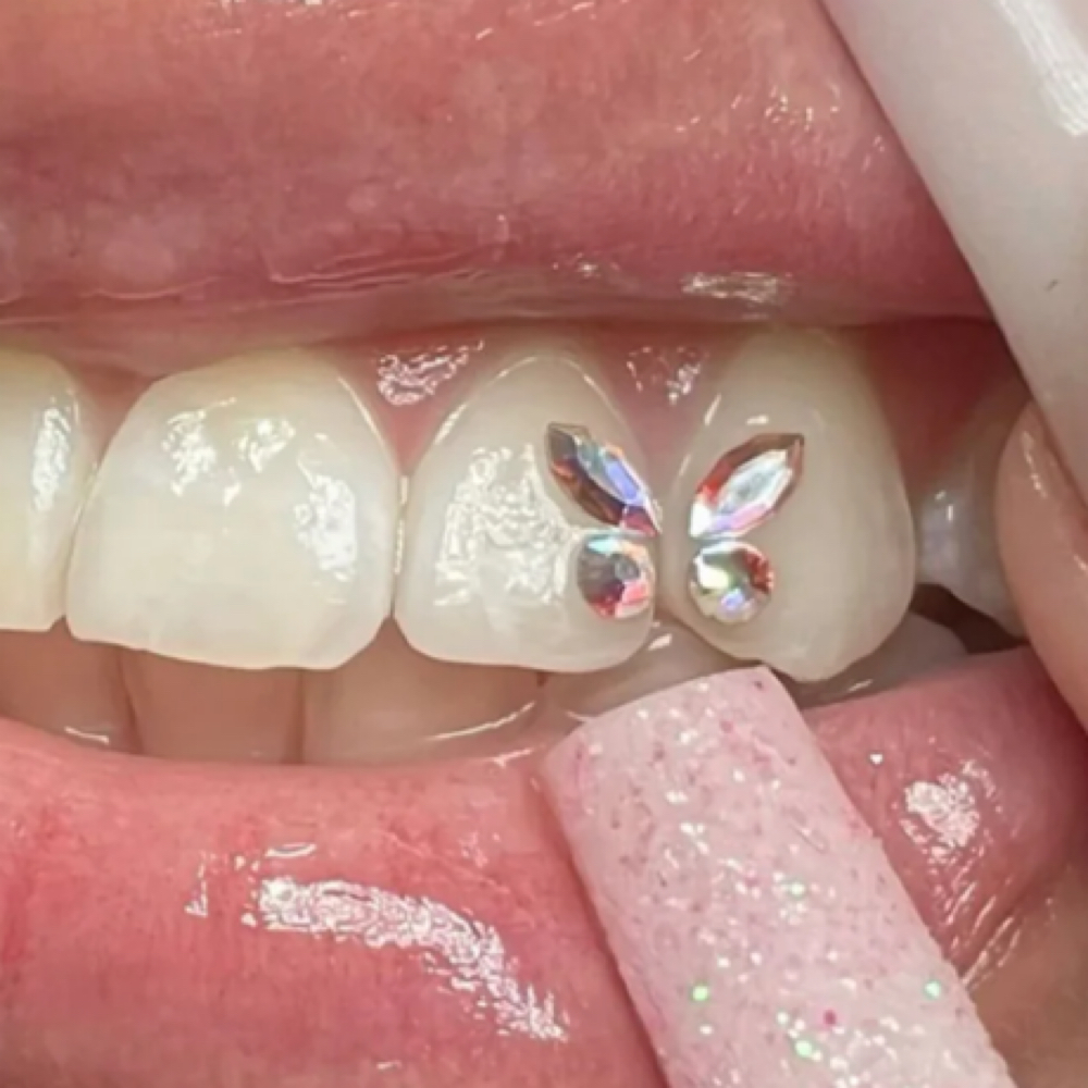 Tooth Gems at Pink Esthetics in Waynesboro, VA