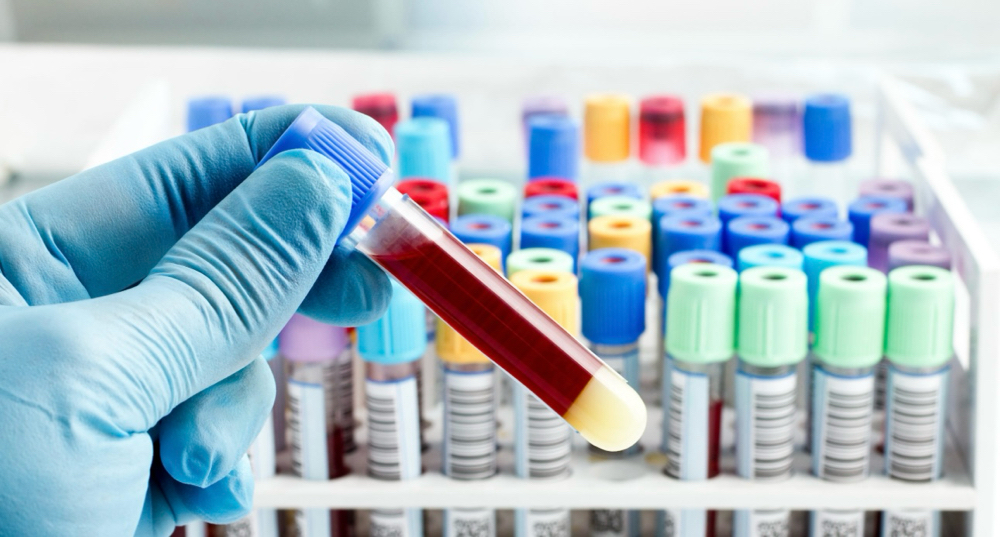 Blood Work