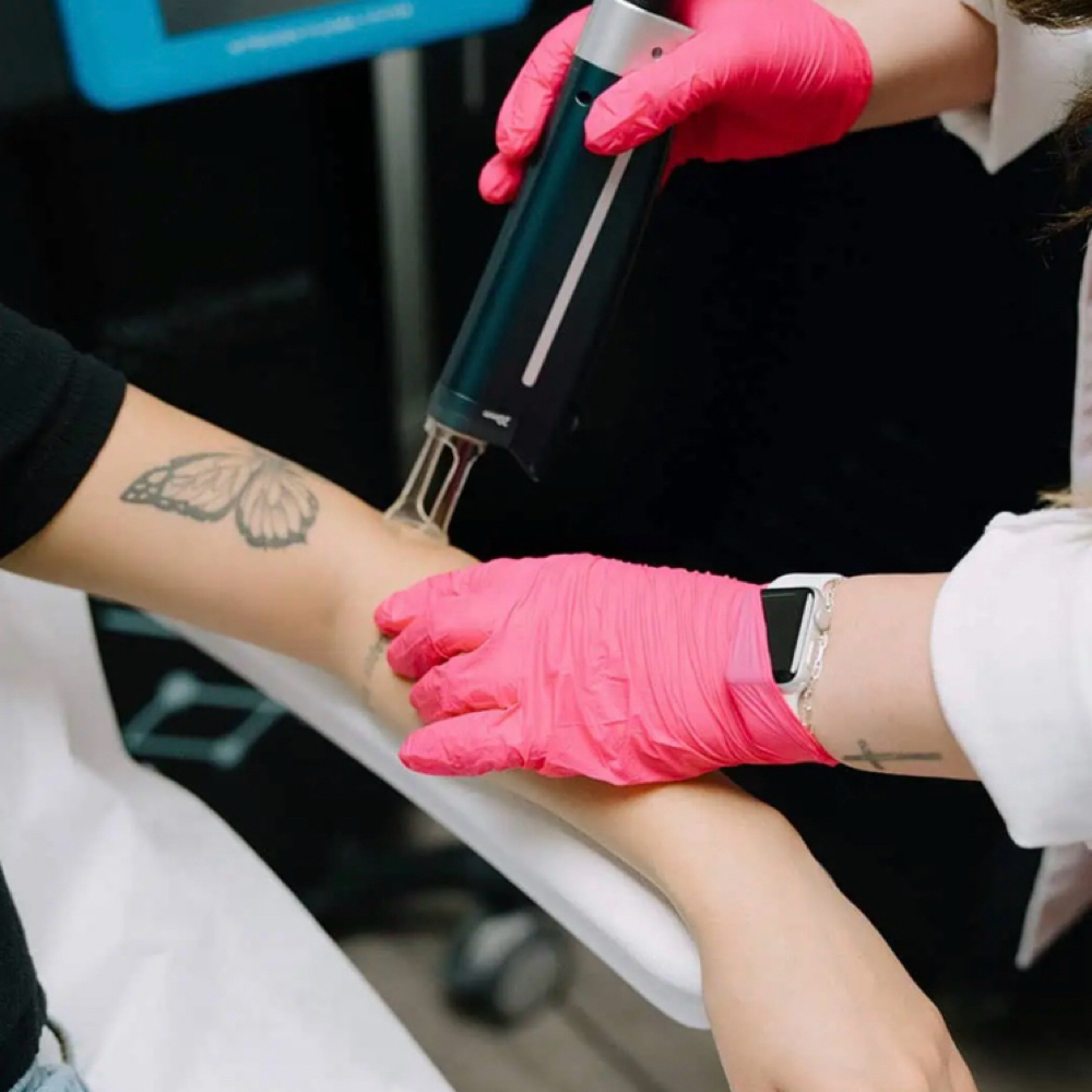 Tattoo Removal at Poke Me Pretty Aesthetics in Cleburne, TX
