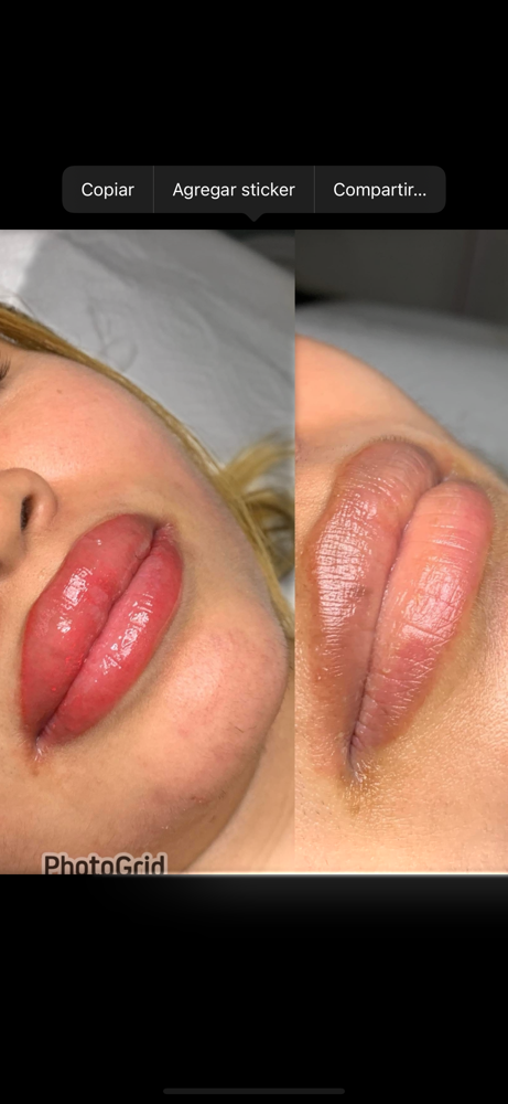 Neutralizacion De Labios at DarleEyes_Studio in Paterson, NJ