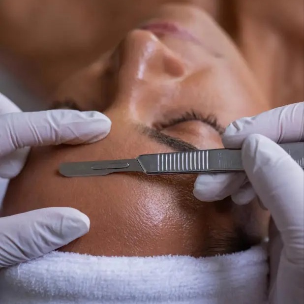 Dermaplaning at On Pointe Esthetics in Geneva, IL