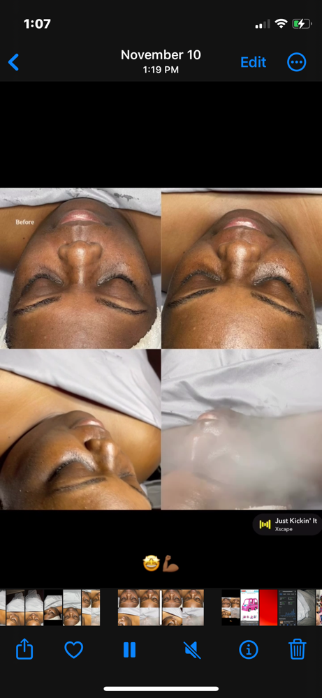 Anti-Aging Facial