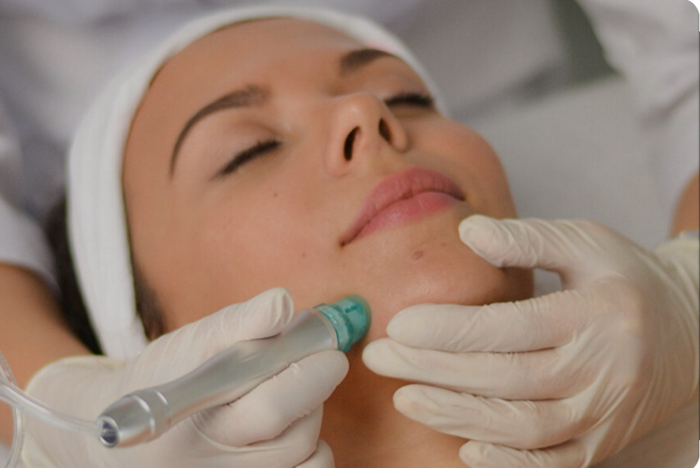 Hydrodermabrasion Facial