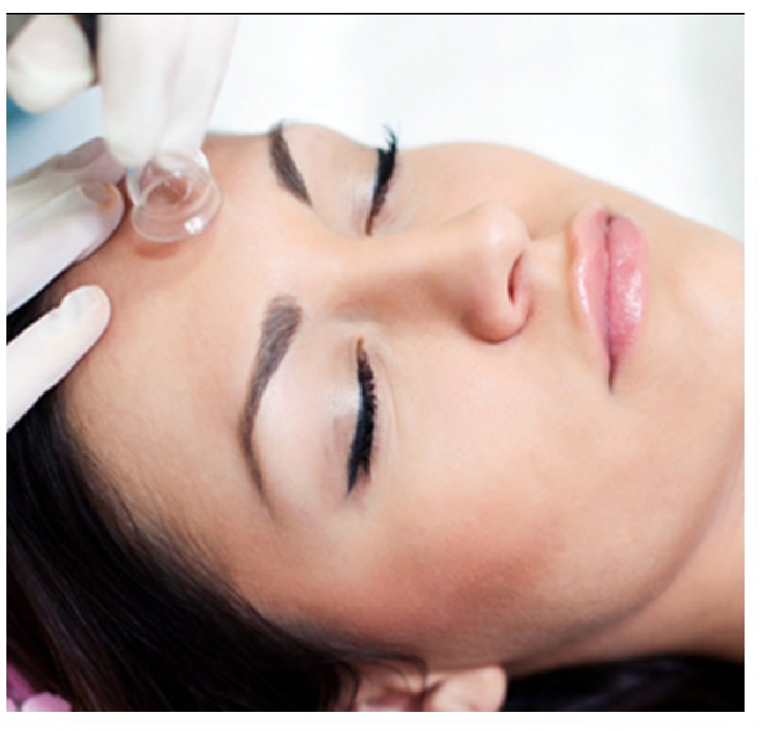 Ventouse Treatment at Facial Sensations in Lewisville, TX