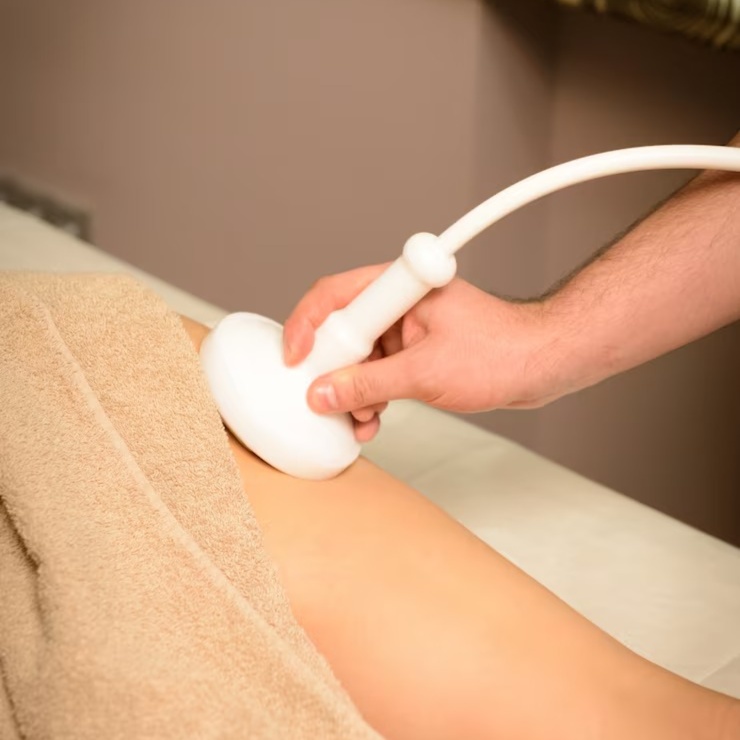 Radio Frequency lipolysis - Arms