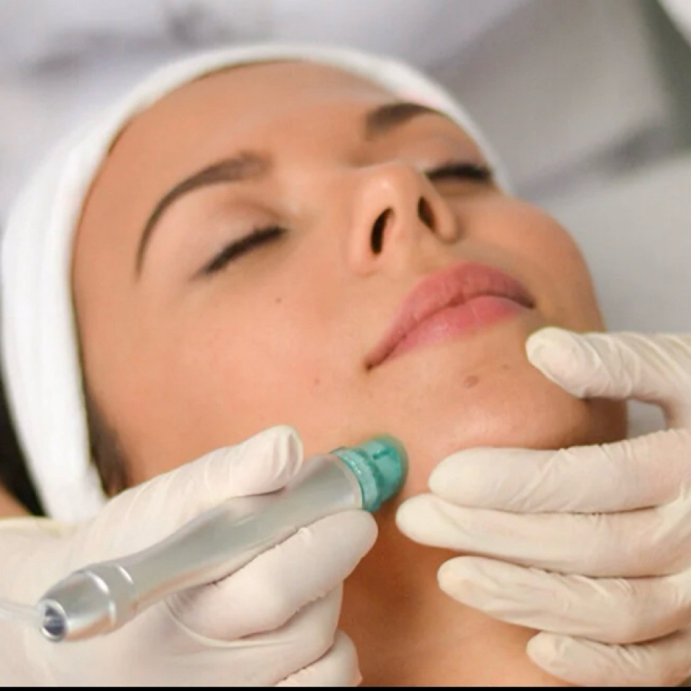 Hydro-Microdermabrasion Facial at The Glow Room, LLC in Lawrenceburg, KY