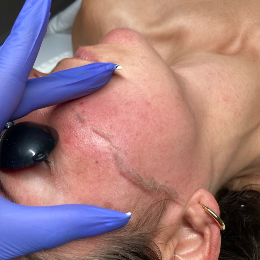 Dermaplaning  *Facial Add-on at FaceTime Beauty Lounge in St. Petersburg, FL