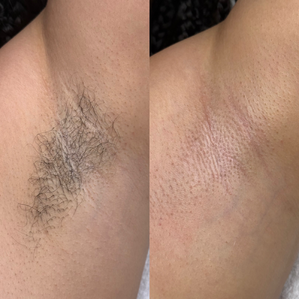 Underarm Wax at Lashed Out by MK in Rochester, NY