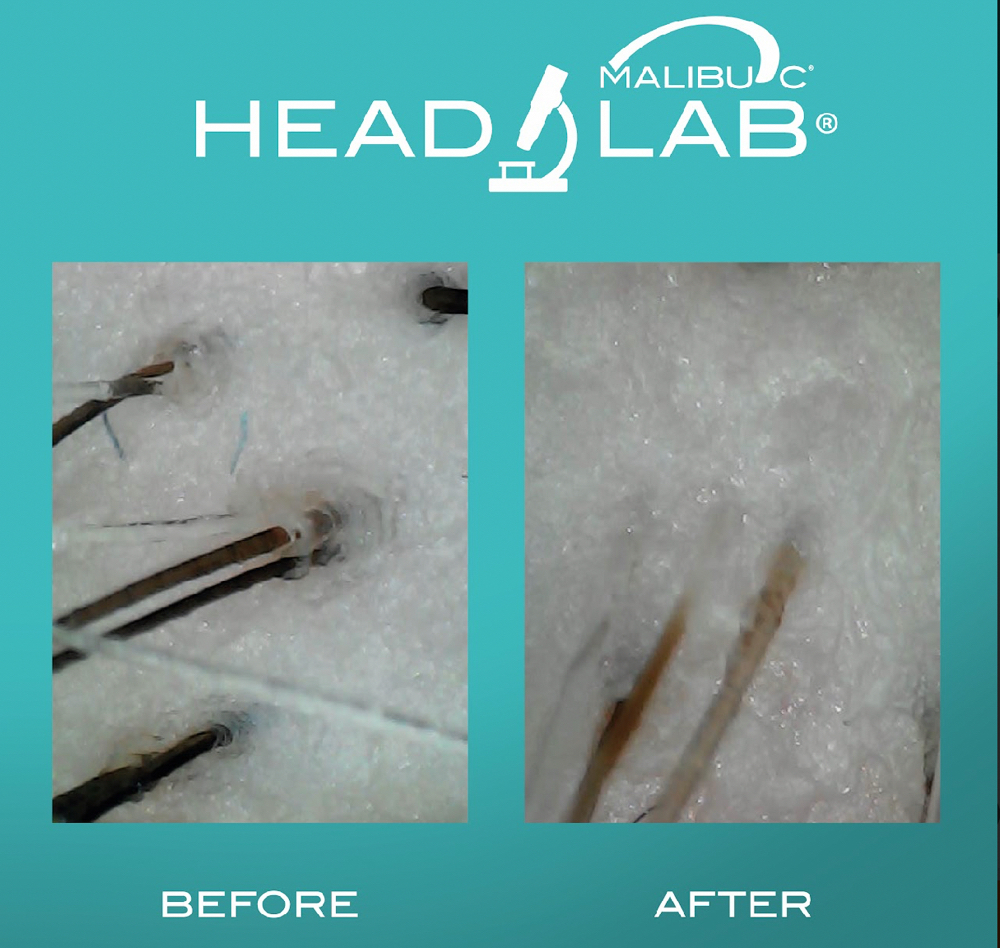 Head Lab Treatment & Style