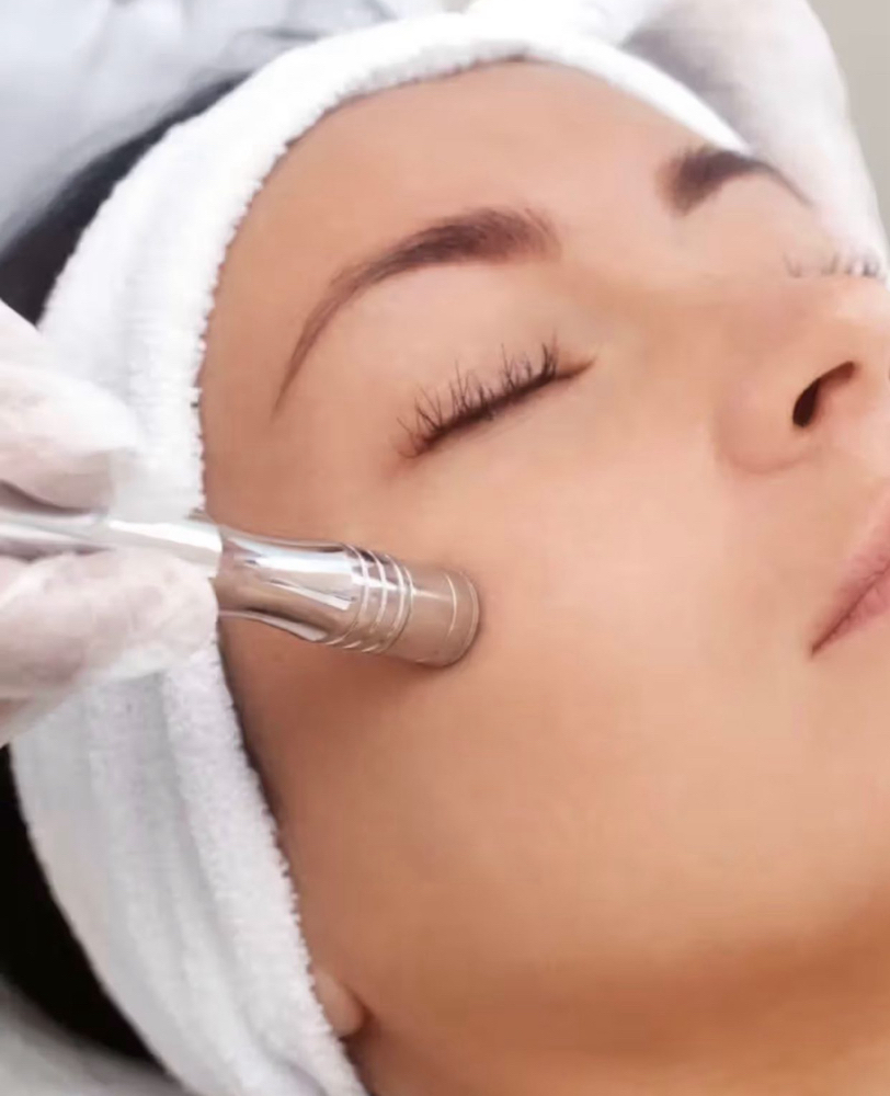 MICRODERMABRASION FACIAL at Skin Rite in Eastchester, NY