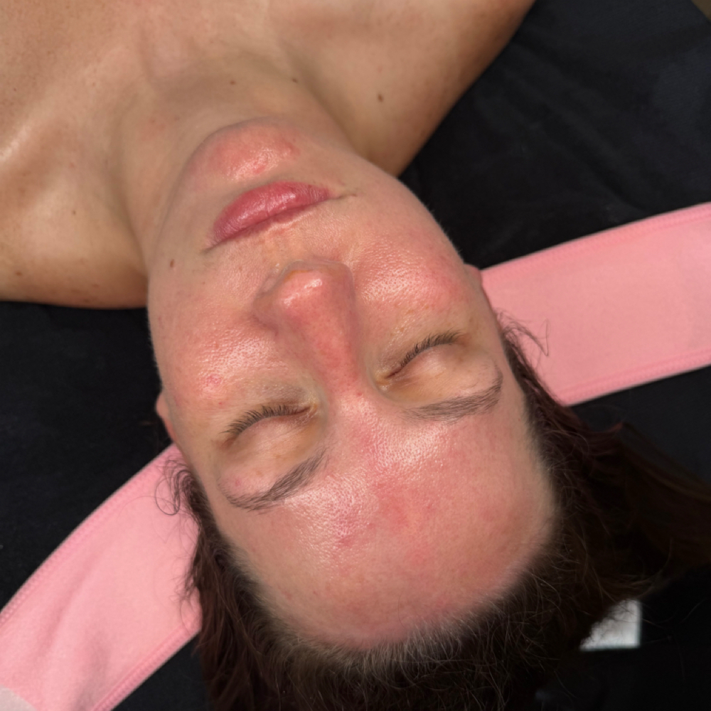 Microdermabrasion Facial at Skin Babe Studio LLC in Fernandina Beach, FL