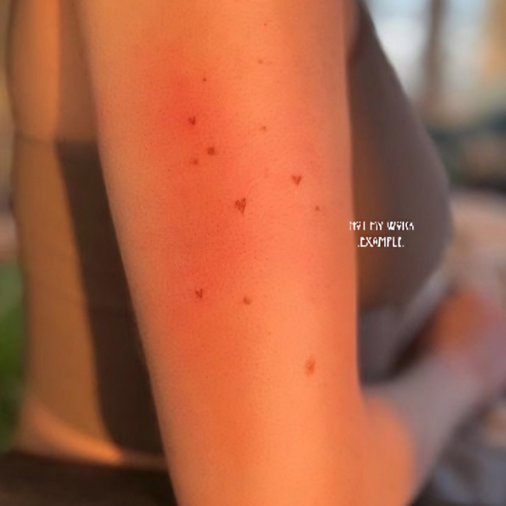Freckles / Beauty Mark at Batty Beauty Studio LLC in Chandler, AZ