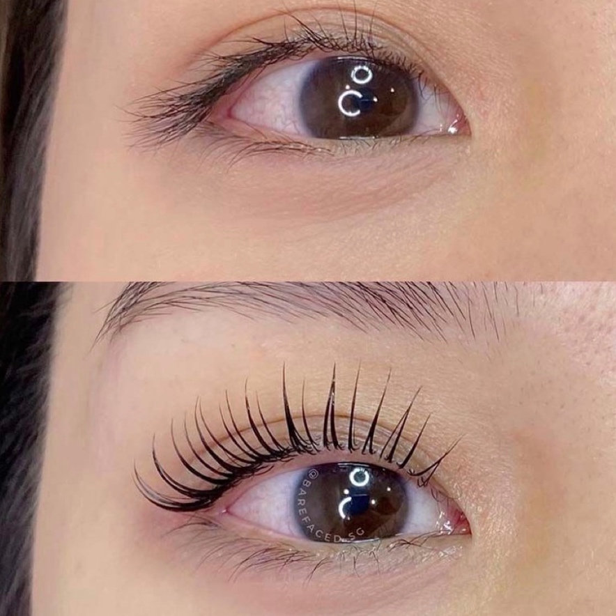 Eyelash Lift