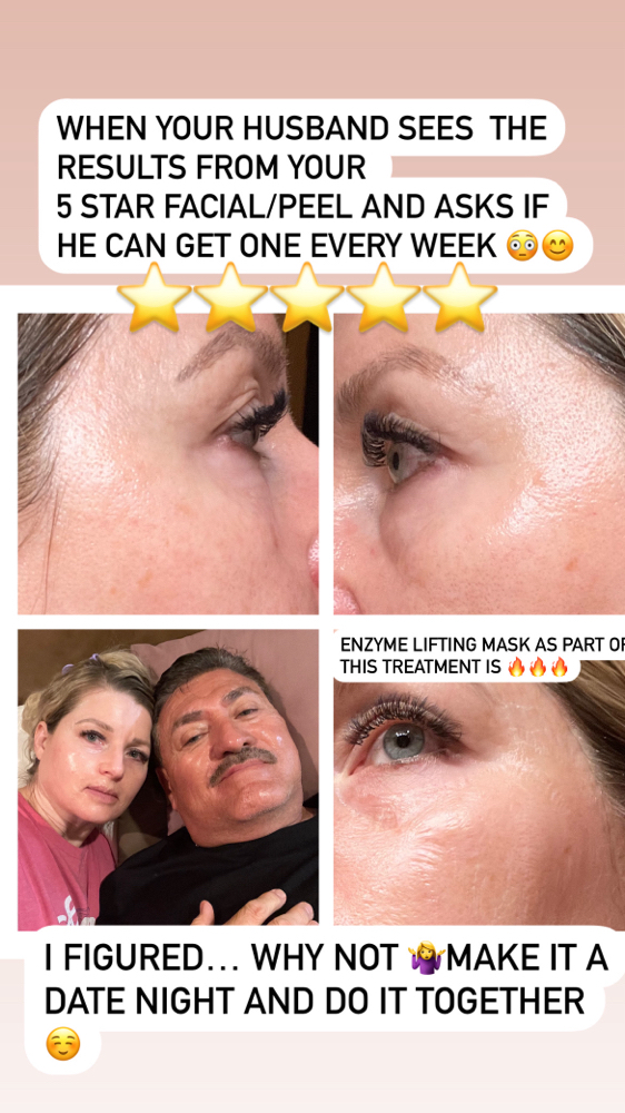 Five ⭐️ Facial/Peel